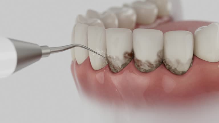 Trusted Tooth Extraction service in Friendship Heights Village, MD - Dentist Open Now